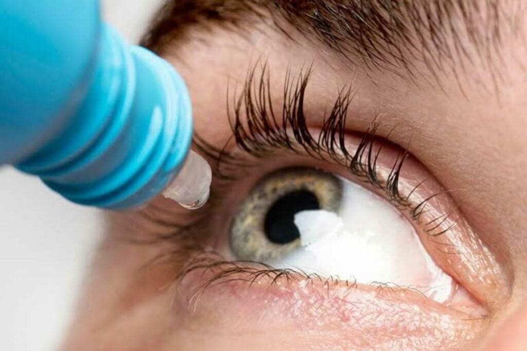 Olho recebendo colírio para tratamento da síndrome do olho seco, destacando a importância da lubrificação ocular.